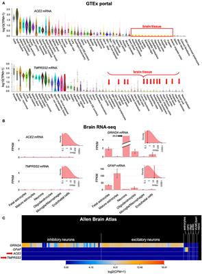 SARS-CoV-2 Is Not Detected in the Cerebrospinal Fluid of Encephalopathic COVID-19 Patients